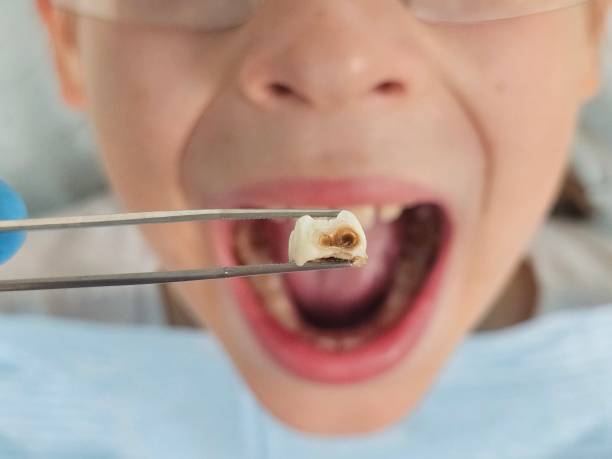 Professional Emergency Dentist in SD